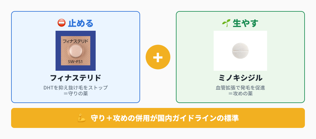 フィナステリド（守り）とミノキシジル（攻め）の併用が標準治療