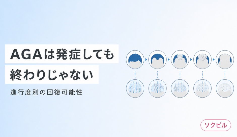 AGAは発症しても終わりじゃない 進行度別の回復可能性と今やるべきこと
