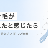 抜け毛が増えたと感じたら読む記事 原因の見分け方と正しい治療法